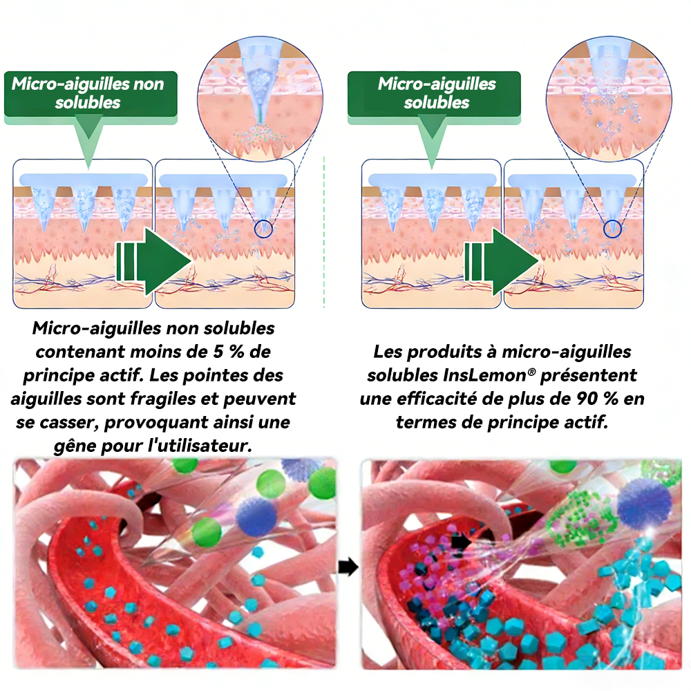 𝐈𝐧𝐬𝐋𝐞𝐦𝐨𝐧® 𝗠𝗼𝗿𝗶𝗻𝗴𝗮 × 𝗕𝗲𝗿𝗯𝗲𝗿𝗶𝗻𝗲 × 𝗔𝗠𝗣𝗞 𝟭𝟬-𝗲𝗻-𝟭 𝗦𝗼𝘂𝘁𝗶𝗲𝗻 𝗠é𝘁𝗮𝗯𝗼𝗹𝗶𝗾𝘂𝗲 𝗣𝗮𝘁𝗰𝗵 à 𝗡𝗮𝗻𝗼-𝗠𝗶𝗰𝗿𝗼𝗮𝗶𝗴𝘂𝗶𝗹𝗹𝗲𝘀(𝐔𝐧𝐞 𝐬𝐞𝐮𝐥𝐞 𝐟𝐨𝐢𝐬 𝐩𝐚𝐫 𝐣𝐨𝐮𝐫, 𝐜𝐡𝐚𝐧𝐠𝐞𝐦𝐞𝐧𝐭𝐬 𝐯𝐢𝐬𝐢𝐛𝐥𝐞𝐬 𝐞𝐧 𝟕 𝐣𝐨𝐮𝐫𝐬） ✅ 𝐏𝐨𝐮𝐫 𝐥’𝐨𝐛é𝐬𝐢𝐭é, 🅟🅔🅐🅤 🅡🅔🅛â🅒🅗é🅔,𝐝𝐢𝐚𝐛è𝐭𝐞, 𝐚𝐩𝐧é𝐞 𝐝𝐮 𝐬𝐨𝐦𝐦𝐞𝐢𝐥, 𝐩𝐫𝐨𝐛𝐥è𝐦𝐞𝐬 𝐚𝐫𝐭𝐢𝐜𝐮𝐥𝐚𝐢𝐫𝐞𝐬, 𝐞𝐭 𝐛𝐢𝐞𝐧 𝐩𝐥𝐮𝐬 🌺🌺🌺🌺🌺